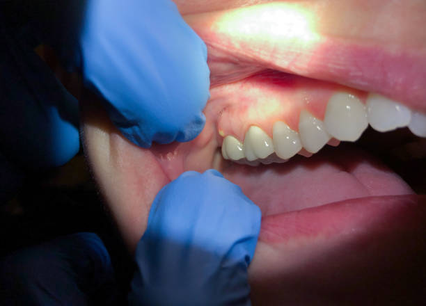 Best Emergency Gum Pain Relief  in Pine Island Center, FL