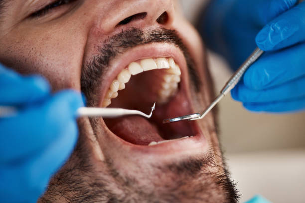Best Tooth Infection Emergency Dentist  in Pine Island Center, FL